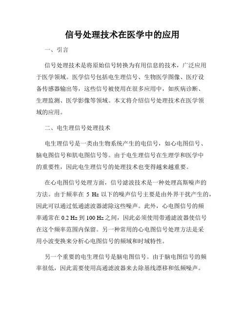 信号处理技术在医学中的应用