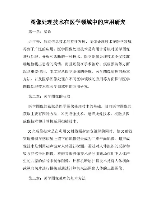 图像处理技术在医学领域中的应用研究