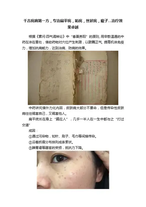 千古疣病第一方，专治扁平疣，跖疣，丝状疣，瘊子…治疗效果卓越