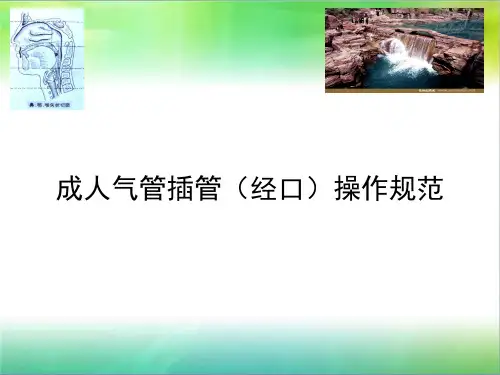 成人气管插管(经口)操作规范