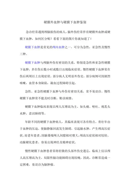 硬膜外血肿与硬膜下血肿鉴别