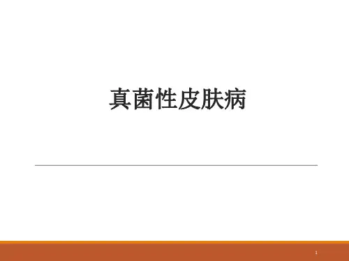 皮肤病学真菌感染性疾病PPT课件