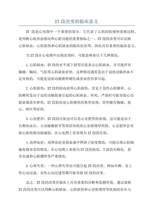 ST段改变的临床意义