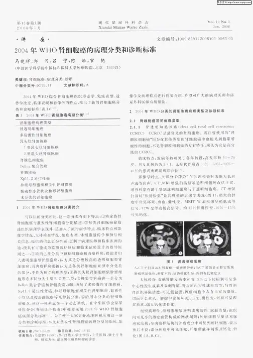 2004年WHO肾细胞癌的病理分类和诊断标准