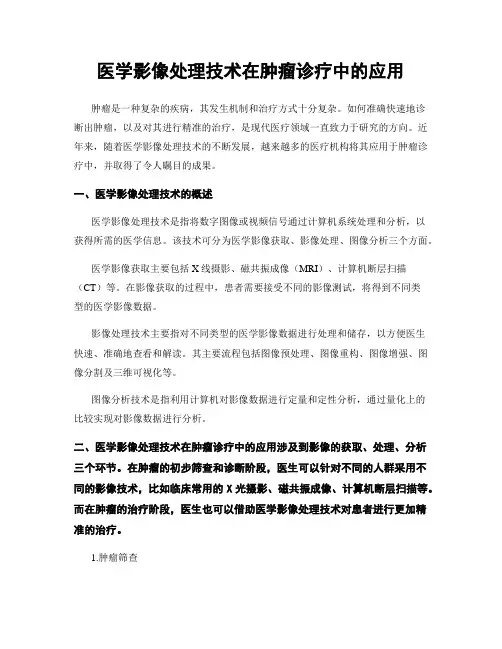 医学影像处理技术在肿瘤诊疗中的应用