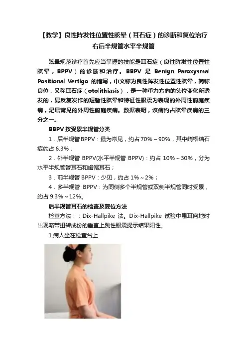 【教学】良性阵发性位置性眩晕（耳石症）的诊断和复位治疗右后半规管水平半规管