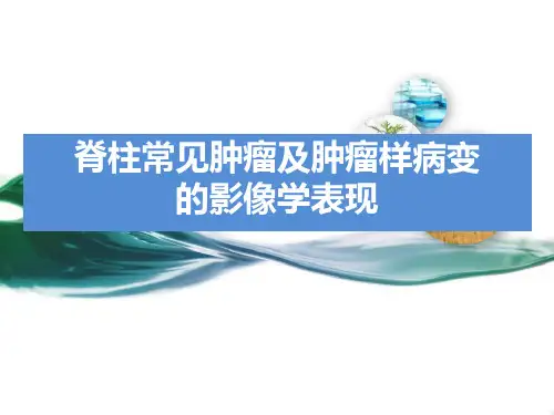 脊柱常见肿瘤及肿瘤样病变的影像学表现