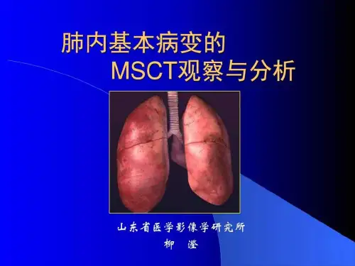 《肺基本病变》PPT课件