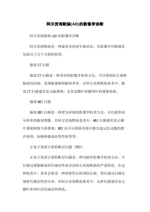 阿尔茨海默病(AD)的影像学诊断
