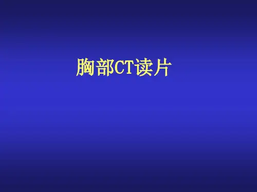 胸部CT读片 优秀PPT讲义