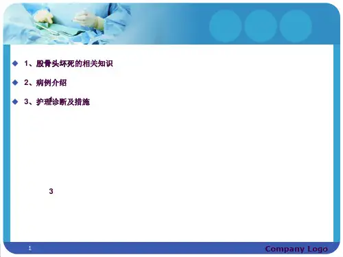 股骨头坏死护理查房ppt课件