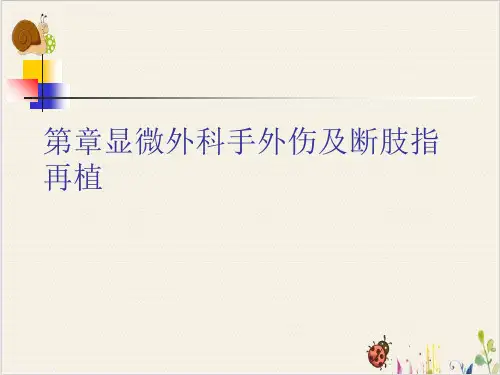显微外科手外伤及断肢指再植PPT.