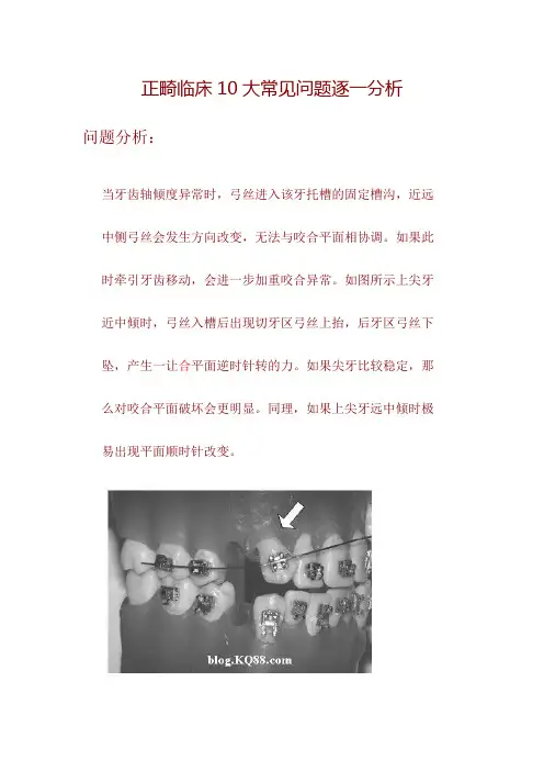 正畸临床10大常见问题逐一分析