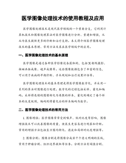 医学图像处理技术的使用教程及应用