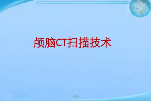 颅脑CTA扫描技术  ppt课件