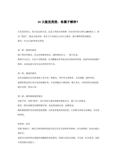十大脱发类型