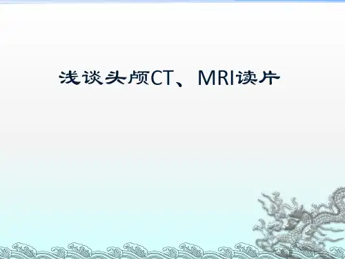 头颅CT及MRI读片技巧