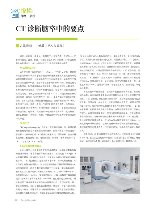 CT诊断脑卒中的要点