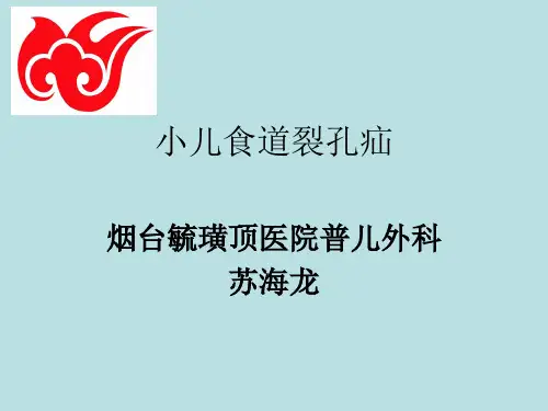 小儿食管裂孔疝