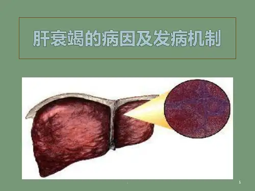 肝衰竭 ppt课件