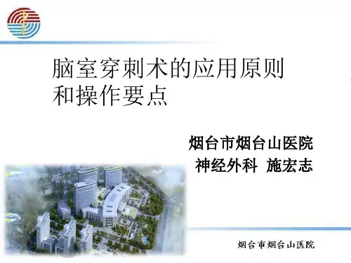 脑室穿刺术