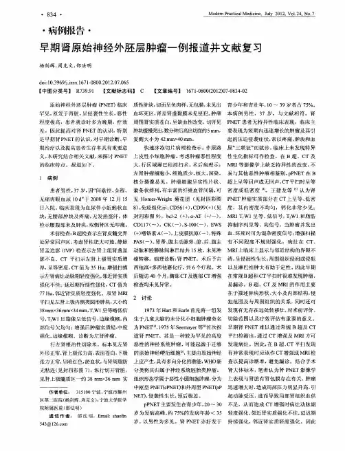 早期肾原始神经外胚层肿瘤一例报道并文献复习
