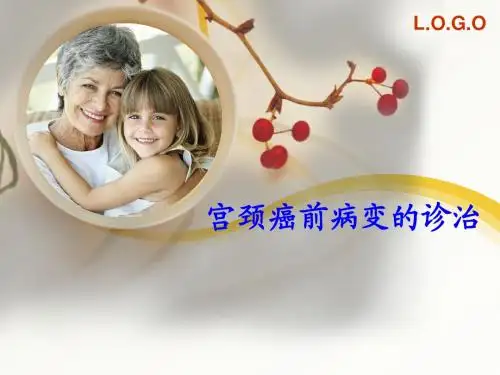 宫颈癌前病变的诊治PPT课件