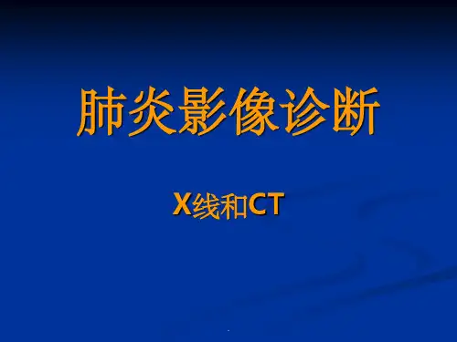 肺炎的X线和CT表现ppt课件