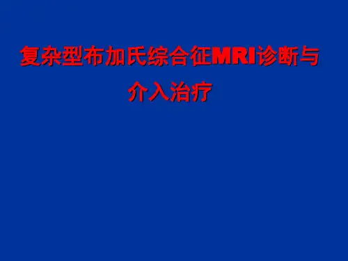 医学交流课件：复杂型布加氏综合征MRI诊断与介入治疗