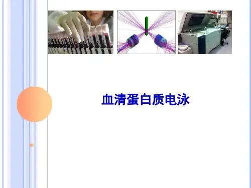6.2血清蛋白质电泳