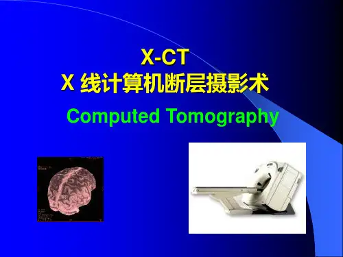 X线计算机断层摄影术