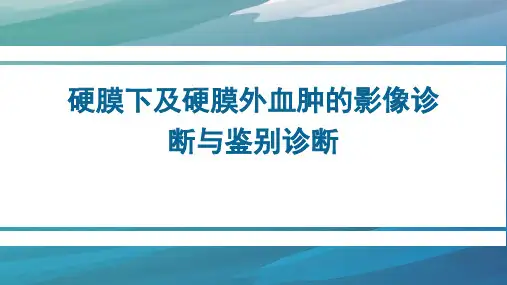 硬膜下及硬膜外血肿的影像诊断与鉴别诊断