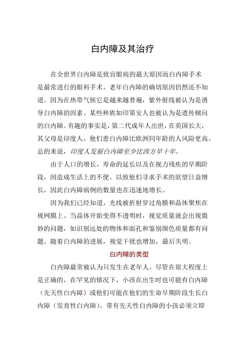 白内障知识