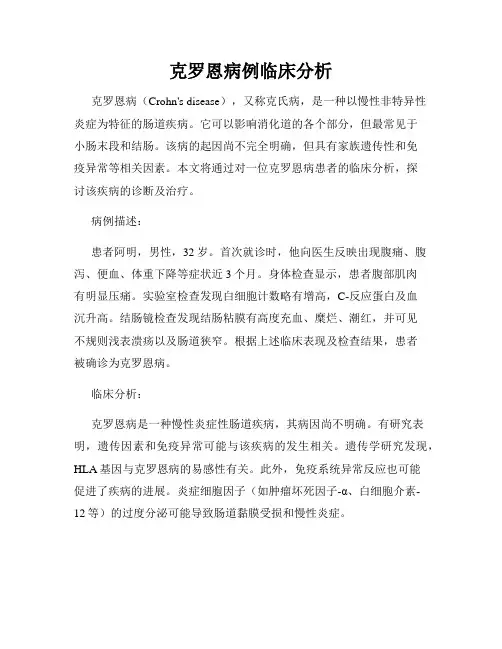 克罗恩病例临床分析