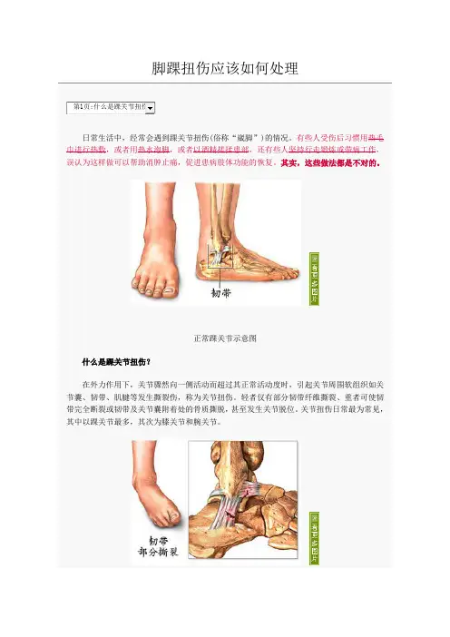 脚踝扭伤如何处理