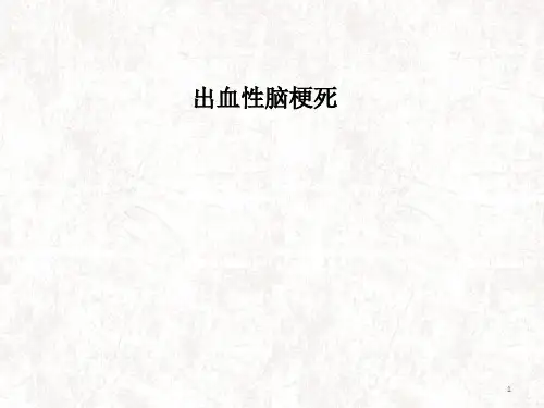 出血性脑梗死ppt课件