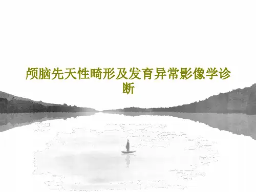 颅脑先天性畸形及发育异常影像学诊断共95页