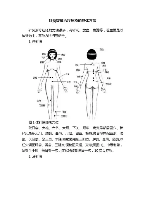针灸拔罐治疗痤疮的具体方法