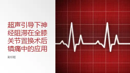 超声引导下神经阻滞在全膝关节置换术后镇痛的应用