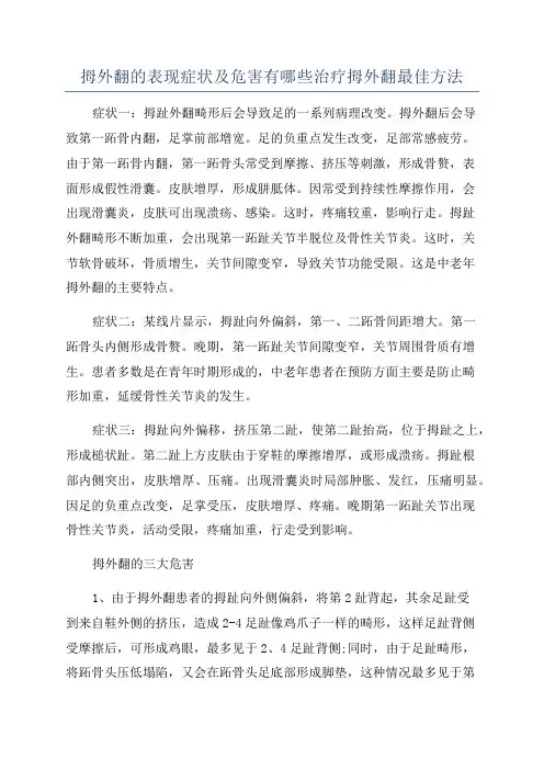 拇外翻的表现症状及危害有哪些治疗拇外翻最佳方法