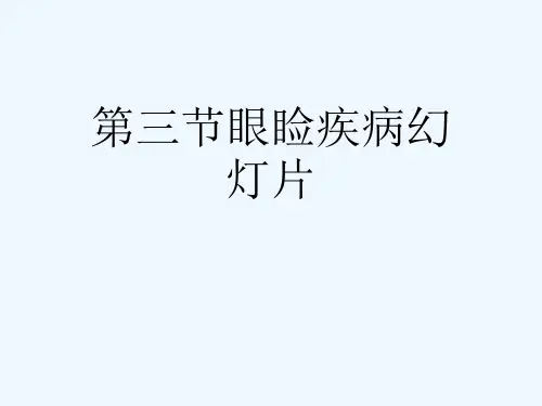 第三节眼睑疾病幻灯片