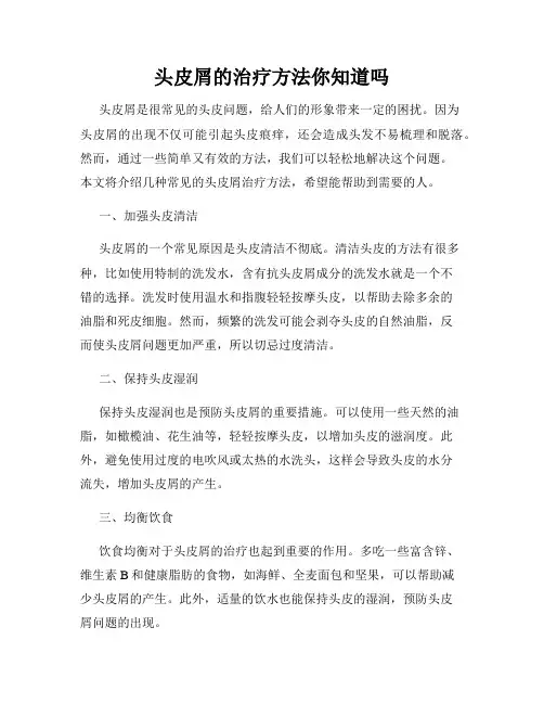 头皮屑的治疗方法你知道吗
