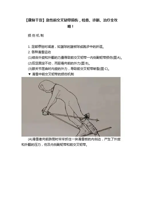 【康复干货】急性前交叉韧带损伤，检查、诊断、治疗全攻略！