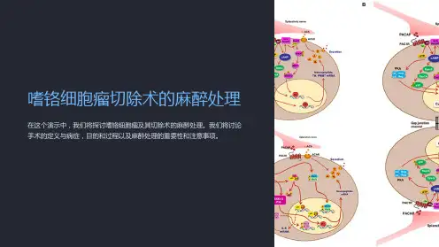 嗜铬细胞瘤切除术的麻醉处理