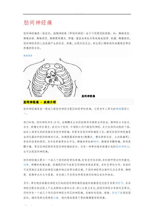 肋间神经痛