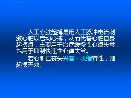 临时起搏器解读ppt课件