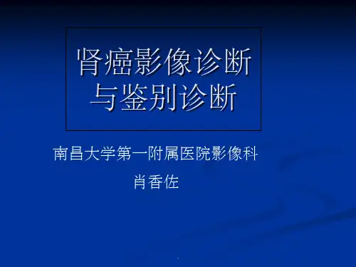 肾癌影像诊断与鉴别诊断ppt课件