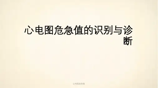 心电图危急值