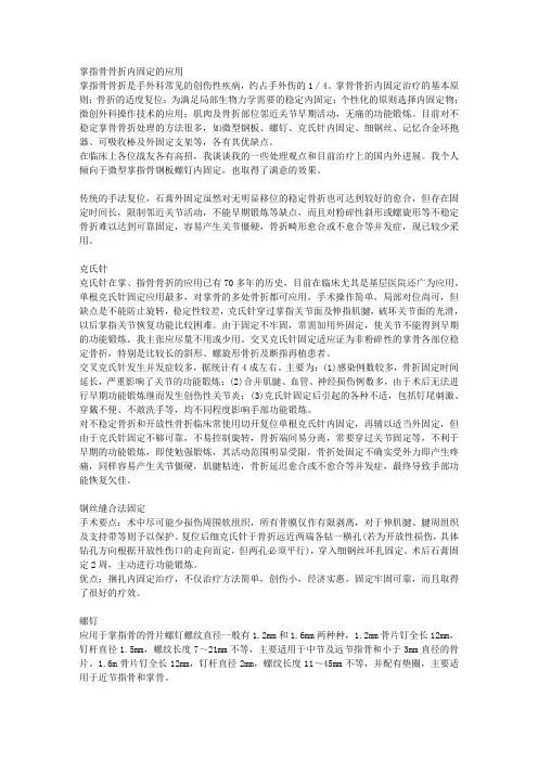 掌指骨骨折内固定的应用