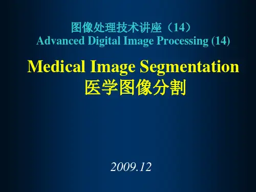 医学图像处理课件-14 医学图像分割